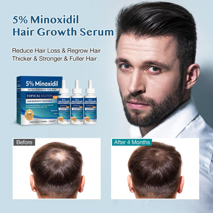 Stafenit 5% Minoxidil Hair Growth Serum for Men and Women — Extra Strength Beard & Scalp Regrowth, 3 x 60ml