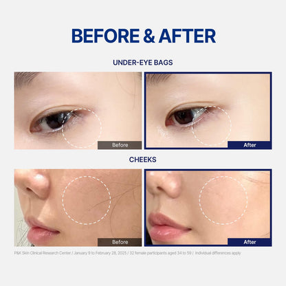 StayUth Wrinkle Spot Serum – Targeted Korean Skincare for Radiance, Hydration & Visible Smoothing (15ml)