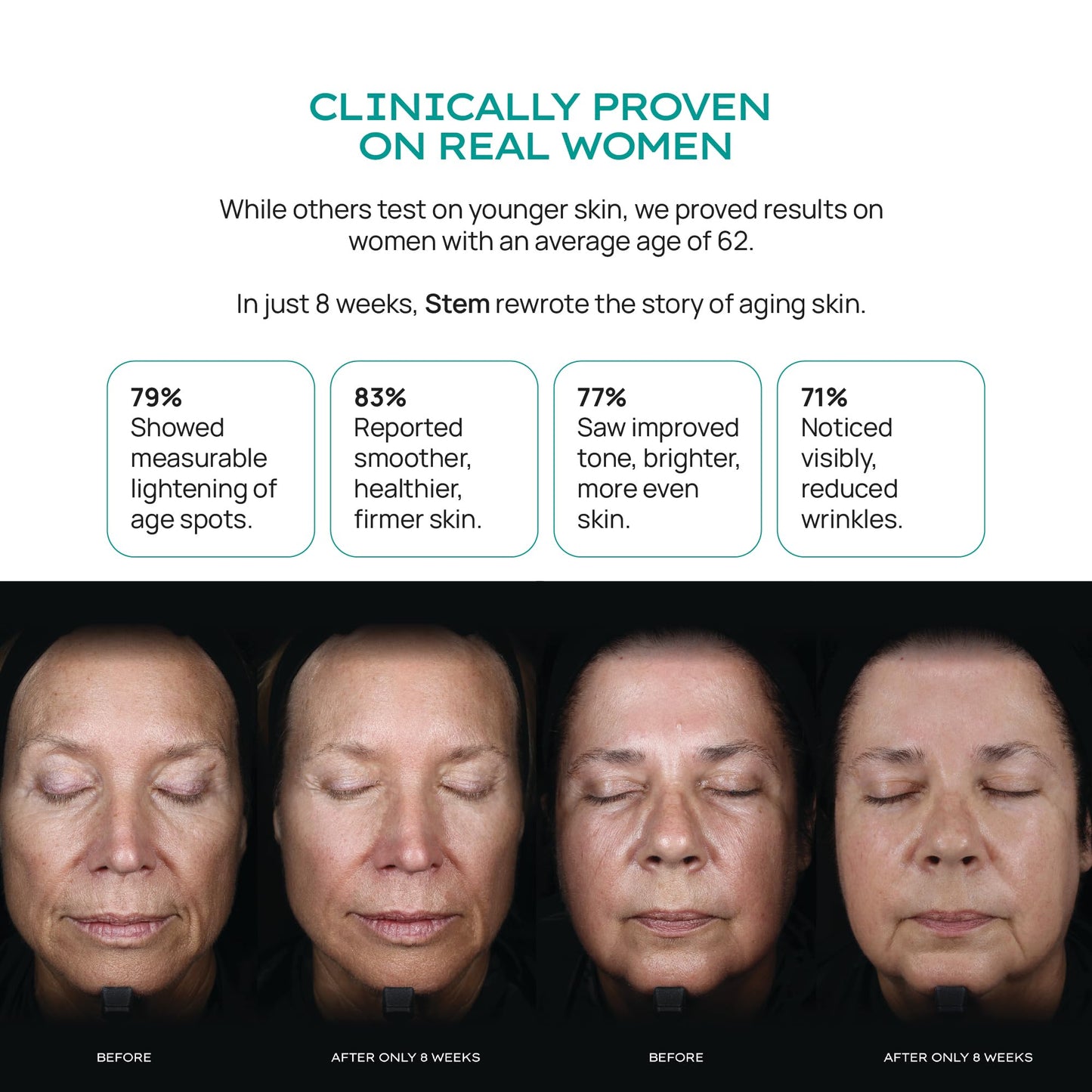 ReVitalize Night Cream — Stem Cell Serum & Niacinamide Moisturizer | STEM Natural Intelligence