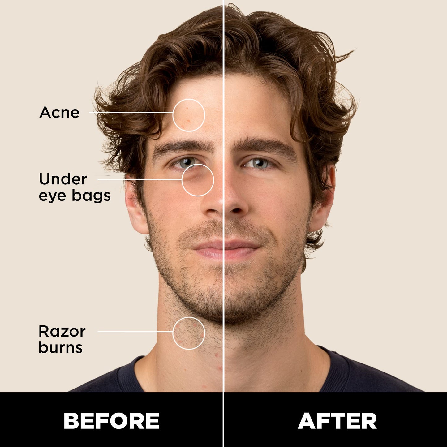 Stryx Concealer Stick Tool for Men - Medium Mahogany | Adaptable Shade & Undetectable Coverage