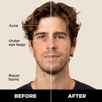 Stryx Concealer Stick Tool for Men - Medium Mahogany | Adaptable Shade & Undetectable Coverage