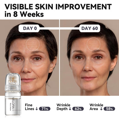 Styirl Micro Infusion System for Face – Hydrating Serum with HA & Peptides (1-Month Supply)