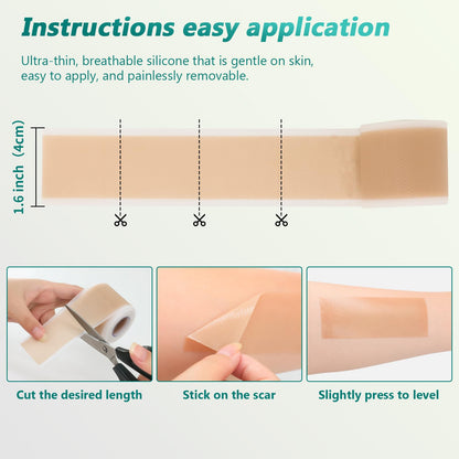 SUCONBE Silicone Scar Tape – Medical Grade Scar Sheets (1.6 x 160 in Roll) for C-Section, Tummy Tuck, and Post-Surgery Scars