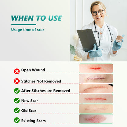 SUCONBE Silicone Scar Tape – Medical Grade Scar Sheets (1.6 x 160 in Roll) for C-Section, Tummy Tuck, and Post-Surgery Scars