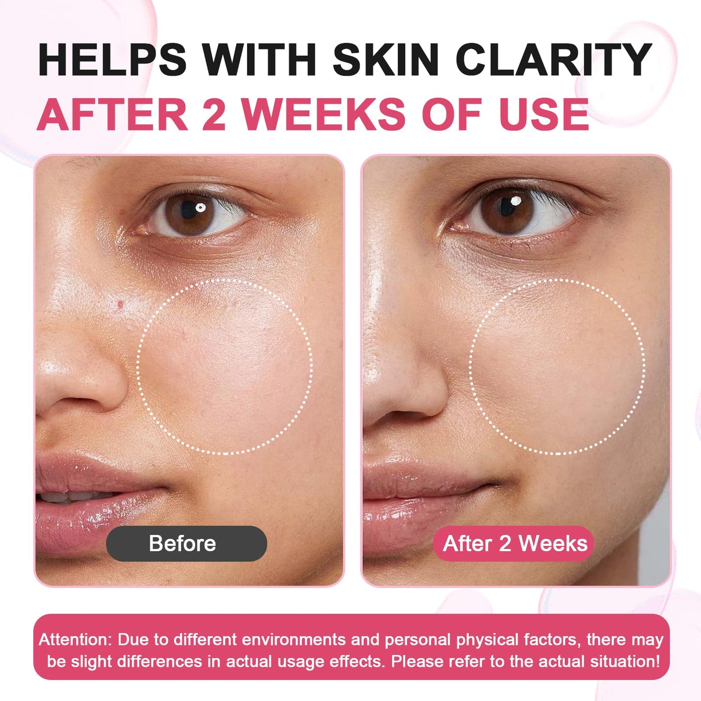 SUDAJI TXA + Niacinamide 15% Serum | Glow Facial Serum with Hyaluronic Acid