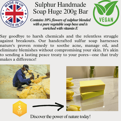 Sulphur Soap Bar 200g – Natural Acne, Rosacea, Eczema & Fungal Treatment UK