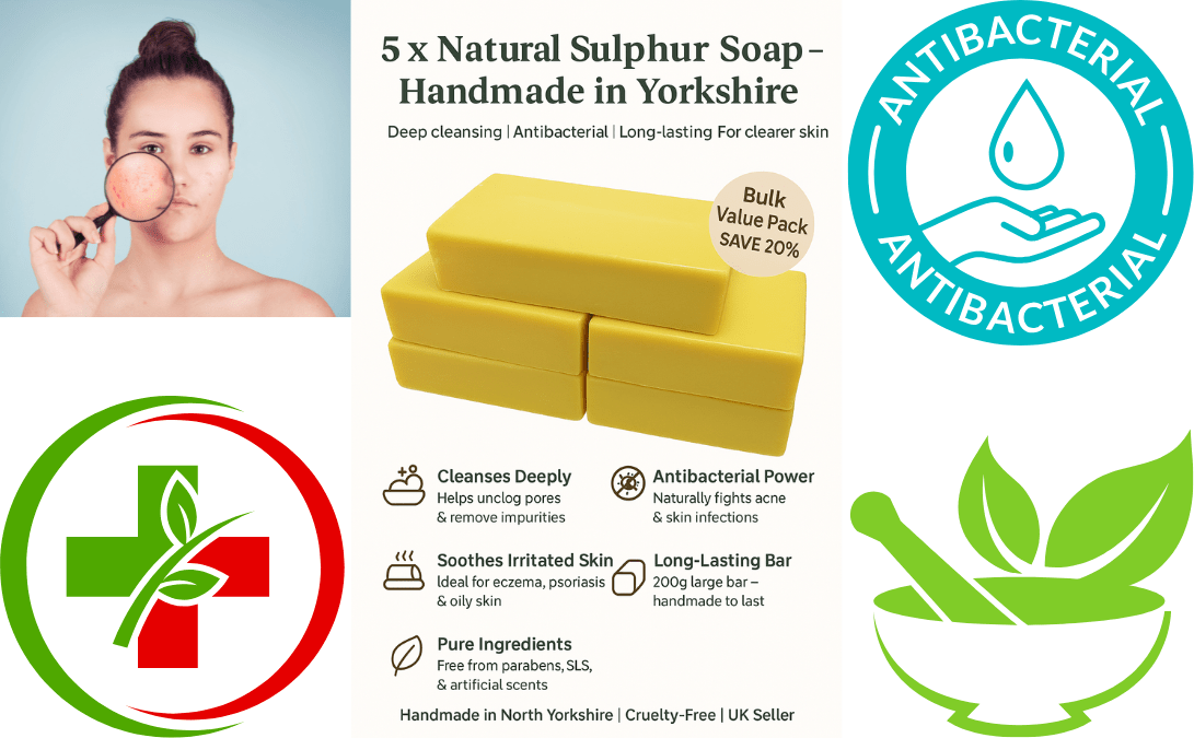 10% Sulphur Soap (200g) for Acne, Rosacea, Eczema & Scabies Relief