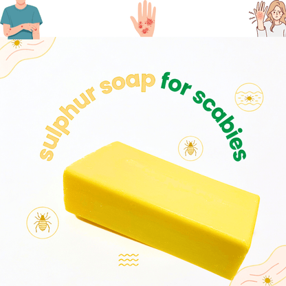 Maximum Strength 10% Sulphur Soap Bar | Handmade in Yorkshire, UK