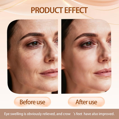 Sunnydeer 2pcs Perfection Eye Tightener with Brush – Instant, Lightweight Firming for Fine Lines