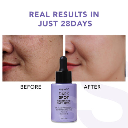 Suquato Dark Spot Remover Serum – Brighten, Correct Discoloration & Hydrate with Tranexamic Acid, Niacinamide & Vitamin C (30ml)