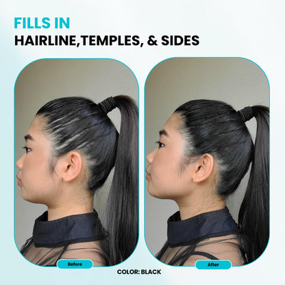 SURETHIK Medium Brown Hair Fibers for Thinning Hair - 30g | Instant Fuller Look for Men & Women