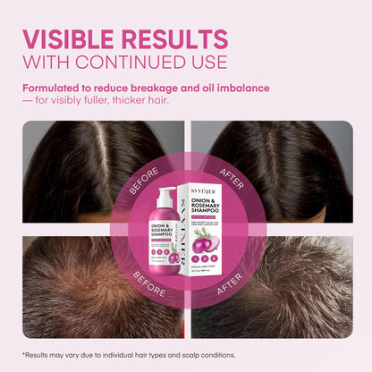 Svvimer Onion Rosemary & Biotin Shampoo — Volumizing, Sulfate-Free Hair Thickening 13.5 oz (Pack of 1)