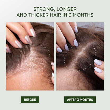 Svvimer Rosemary Hair Growth Shampoo – Thickening & Regrowth Formula with Biotin & Tea Tree Oil (11.8 fl oz)