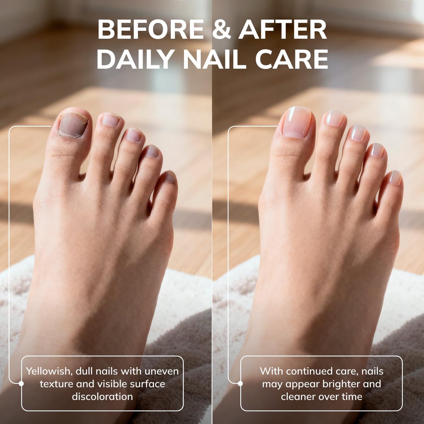 Swissklip Medi-Care KlearNail Toenail Stick – Natural Nail Renewal for Brittle Nails | Pack of 2 | 10ml | Made in USA