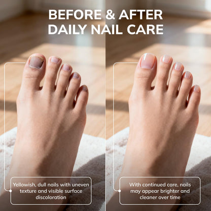 Swissklip Medi-Care KlearNail Toenail Stick – Natural Nail Renewal for Brittle Nails | Pack of 2 | 10ml | Made in USA