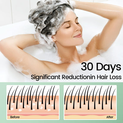 Sysni Rosemary Tea Tree Keratin Shampoo – Hydrating Cleansing for Men & Women