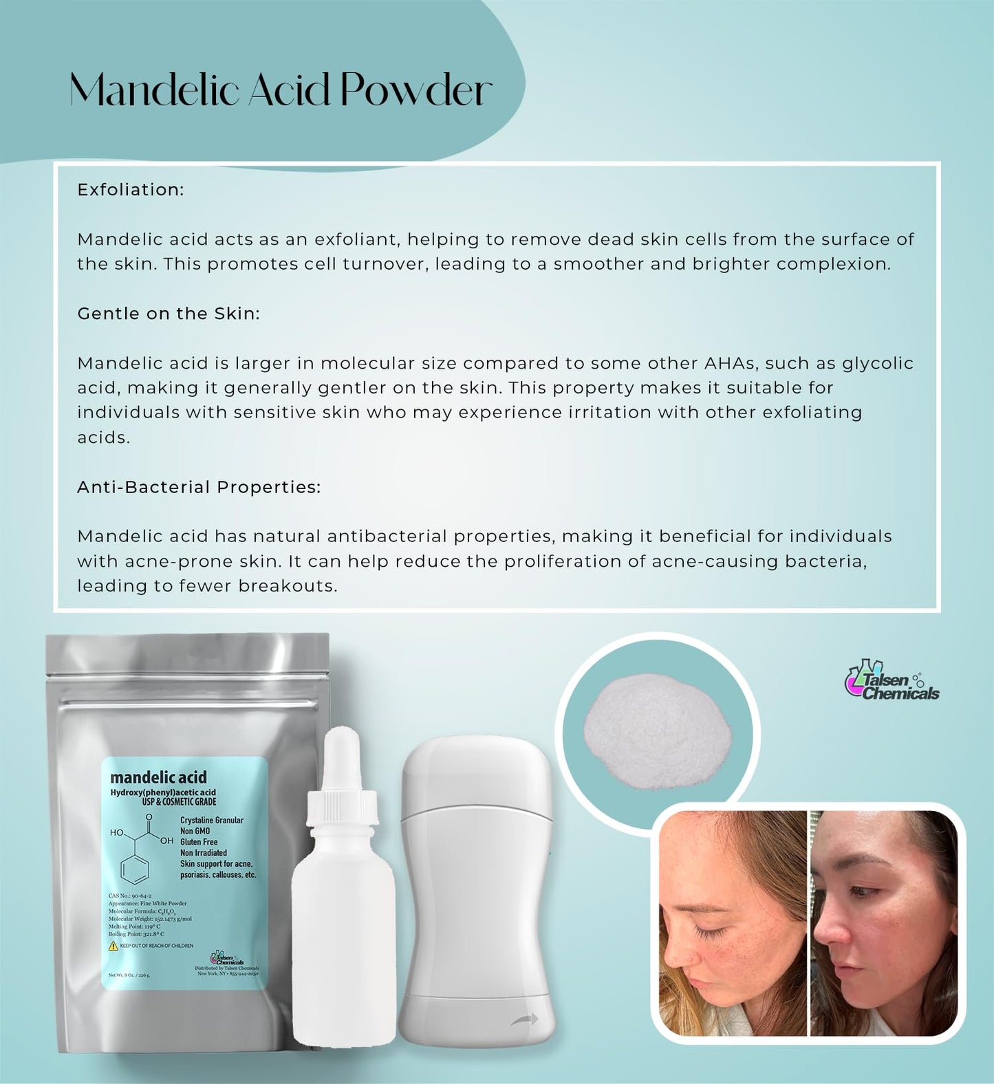 Talsen Chemicals Mandelic Acid Powder 99.9% Purity – DIY Serum, Peel, Mask or Cream 8 oz / 226 g