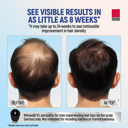 TARO Minoxidil 5% Foam for Men – 2.11 Oz Topical Hair Regrowth Solution (1 Month Supply)