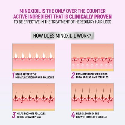 TARO Minoxidil for Women 5% Foam – 2.11 Oz (2 Months) Hair Regrowth Treatment