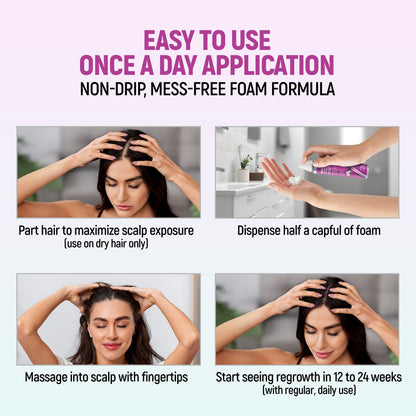 TARO Minoxidil for Women 5% Foam – 2.11 Oz (2 Months) Hair Regrowth Treatment