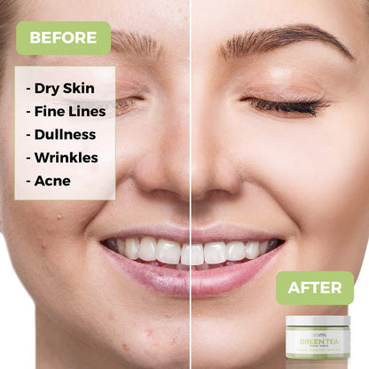 Teami Matcha Green Tea Facial Scrub – Hydrating Exfoliator with Lemongrass