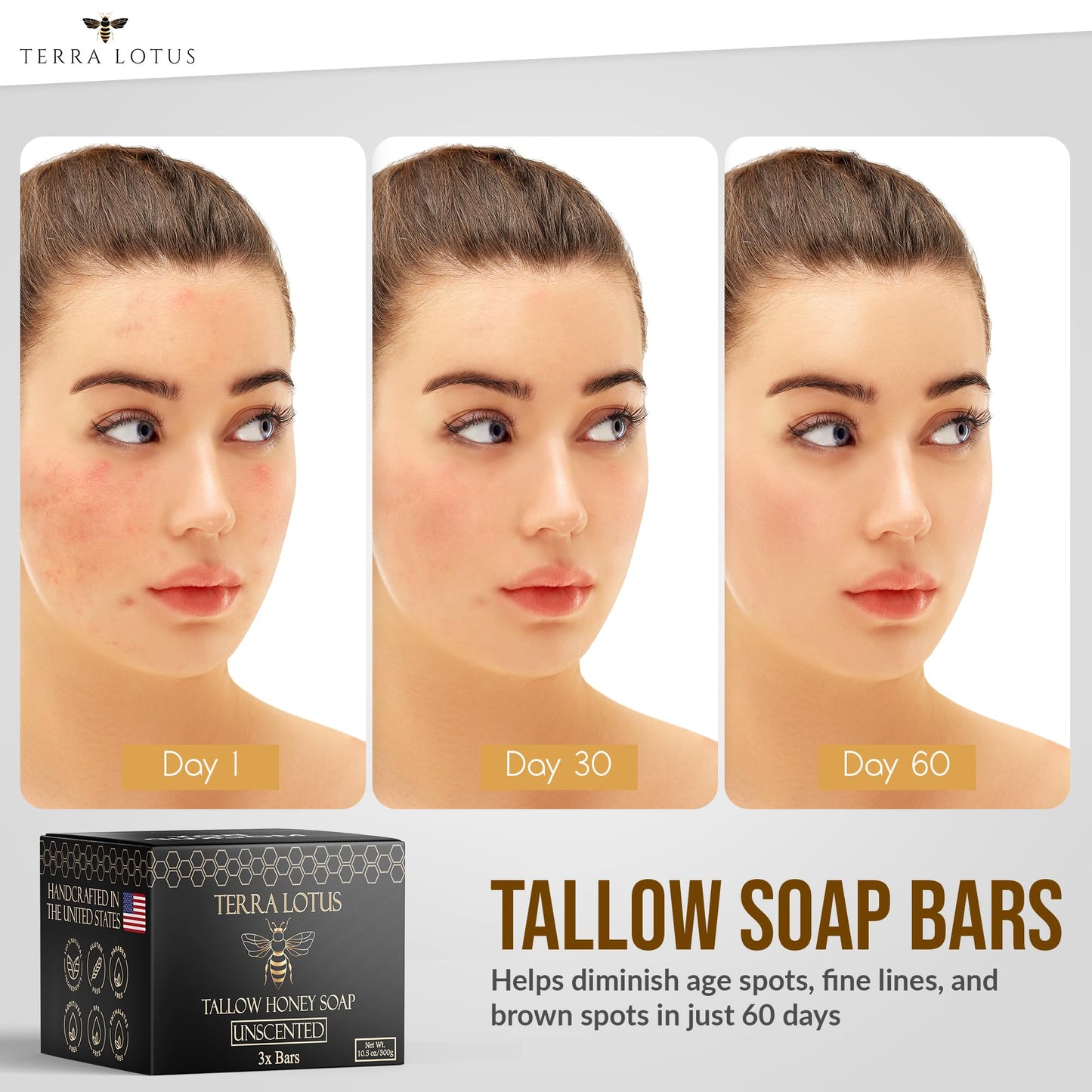 Terra Lotus Organic Tallow Soap with Honey & Castor Oil – 3 Pack Citrus