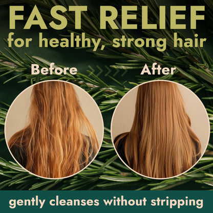 Terramed Just Think Comfort Rosemary Shampoo & Conditioner Set – Tea Tree & Rosemary Oils, Sulfate Free + Free Scalp Brush | 16.9 fl oz