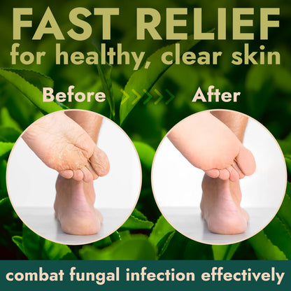 Terramed Just Think Comfort Foot Scrub with Tea Tree Oil – Exfoliating Callus Remover for Feet