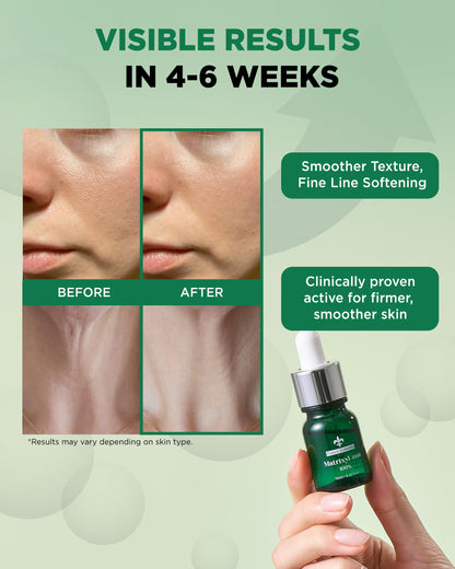 THEPURI Matrixyl 3000 100% Serum Skincare – Pure Peptide Complex Anti-Aging Ampoule 3-Pack (10ml Each)