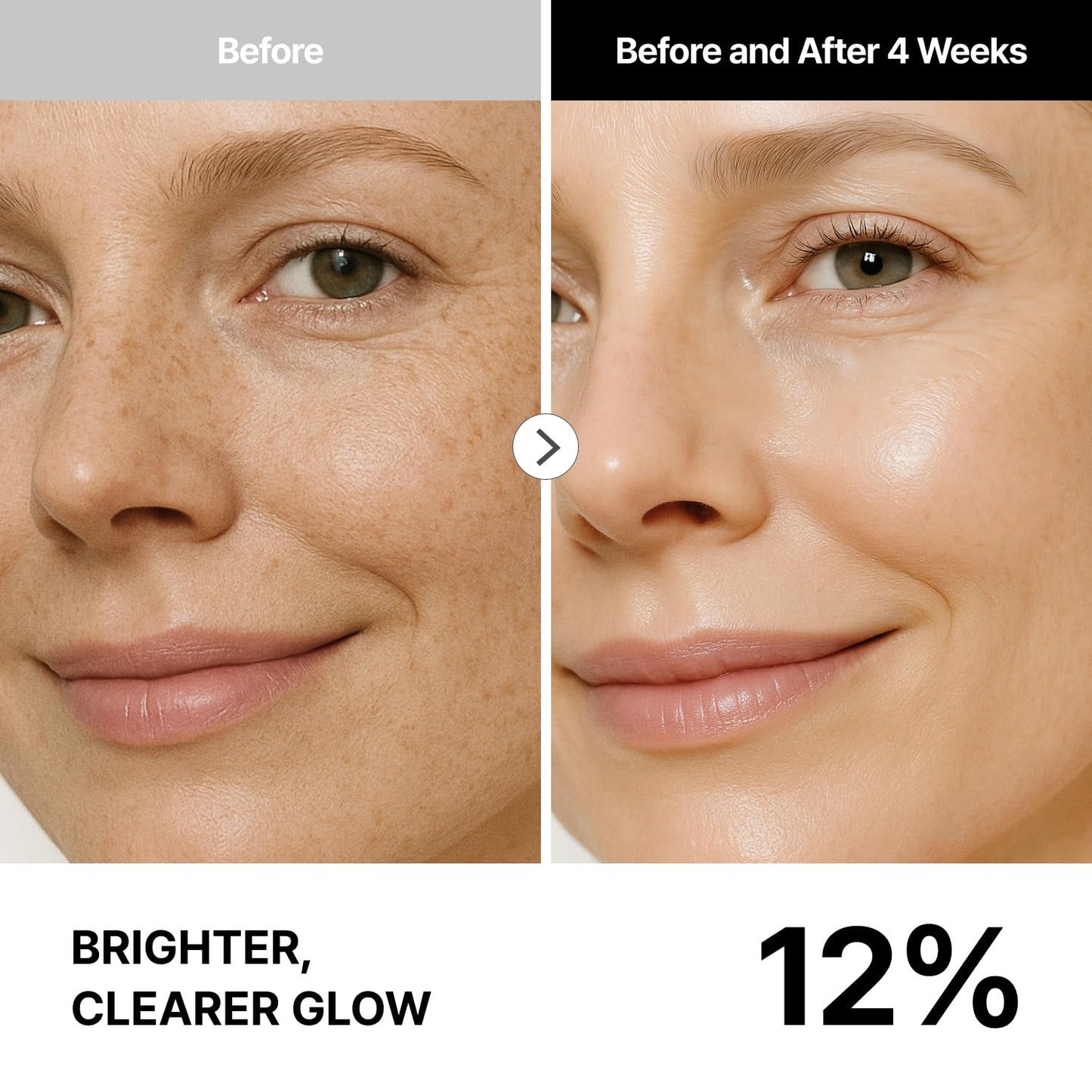 THOME G-Peel 4-Week Kit: Hydrating & Firming Korean Facial – Skin Cycling