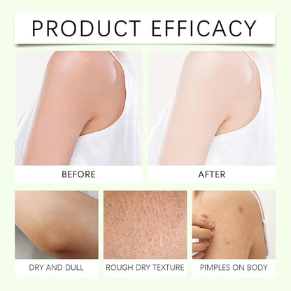 THUIOP Neuropathy Cream & Magnesium Body Butter (2-Pack) – Deep Hydration for Soft, Smooth Skin