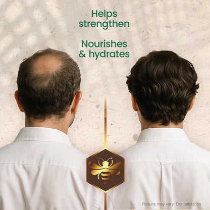 Tio Nacho Mexican Herbs Shampoo – Strengthening, Anti Breakage, Royal Jelly, Ginseng & Jojoba | 32 Fl Oz | Paraben & Cruelty Free