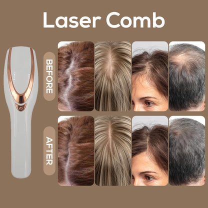 TMOSSO Laser Therapy Hair Growth Comb – Handheld Low-Level Laser Therapy Device for Scalp