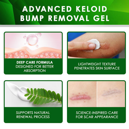 Tobcharm Advanced Keloid Scar Gel – Silicone Scar Care, 2-Pack (30g x2)