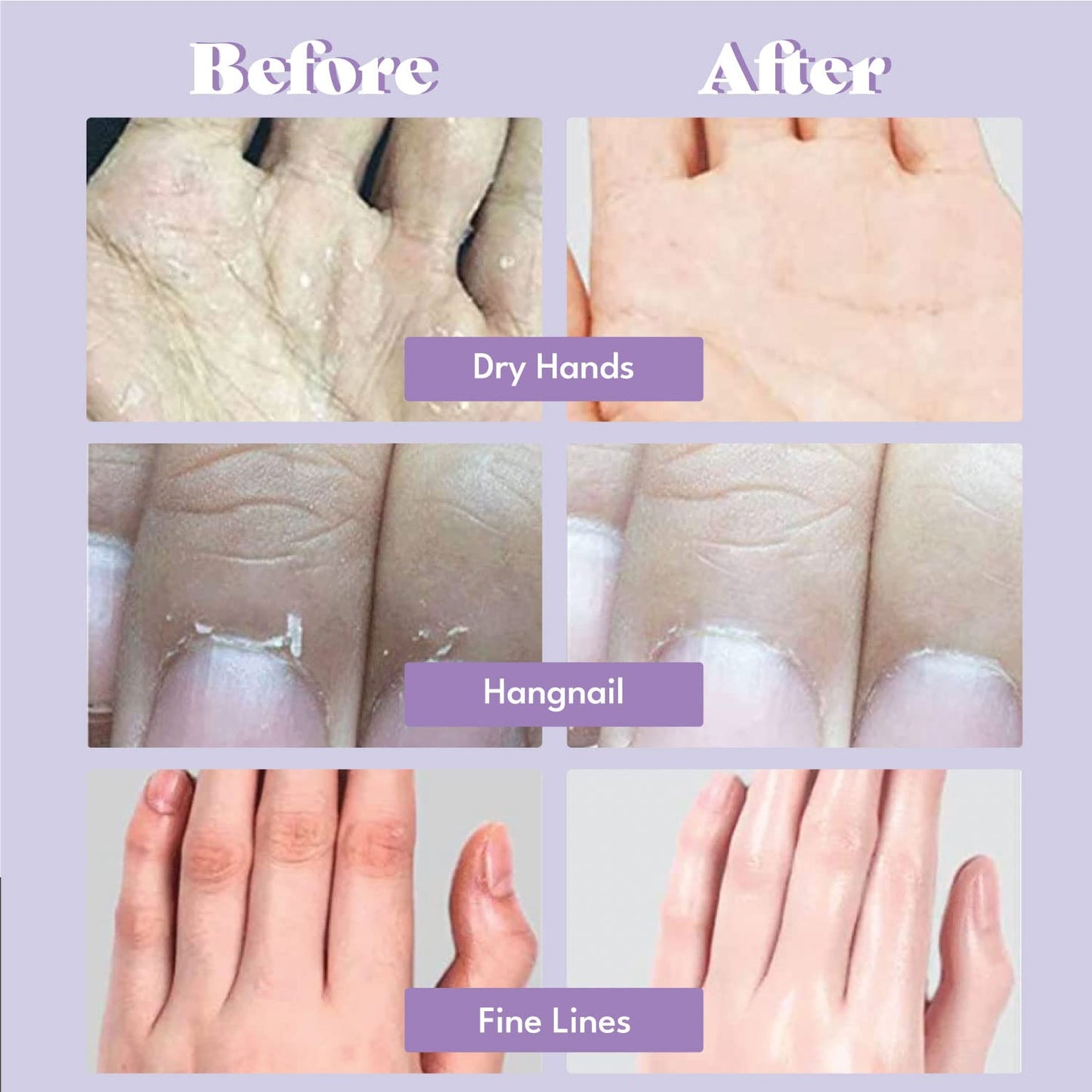 TOI:L Catherine Muller Floral Hand Mask – 8 Pairs Moisturizing Gloves with Elder Flower & CICA