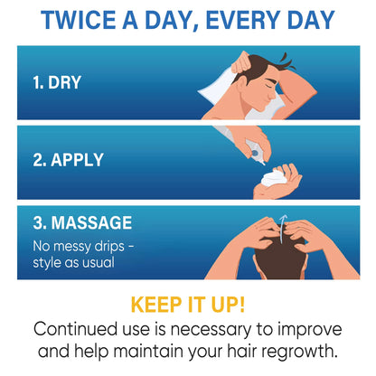 Tomum 5% Minoxidil Foam for Hair Regrowth – Fast-Absorbing, Non-Greasy, For Men & Women