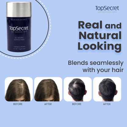 Top Secret Hair Building Fiber Refills – Undetectable Thickening for Men & Women (Medium Brown)