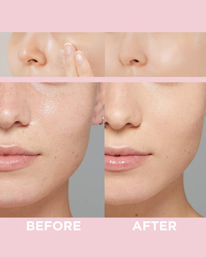 Touch in Sol No Pore Blem Primer – 2 Pack | Pore-Minimizing Face Primer for Smooth, Lasting Makeup