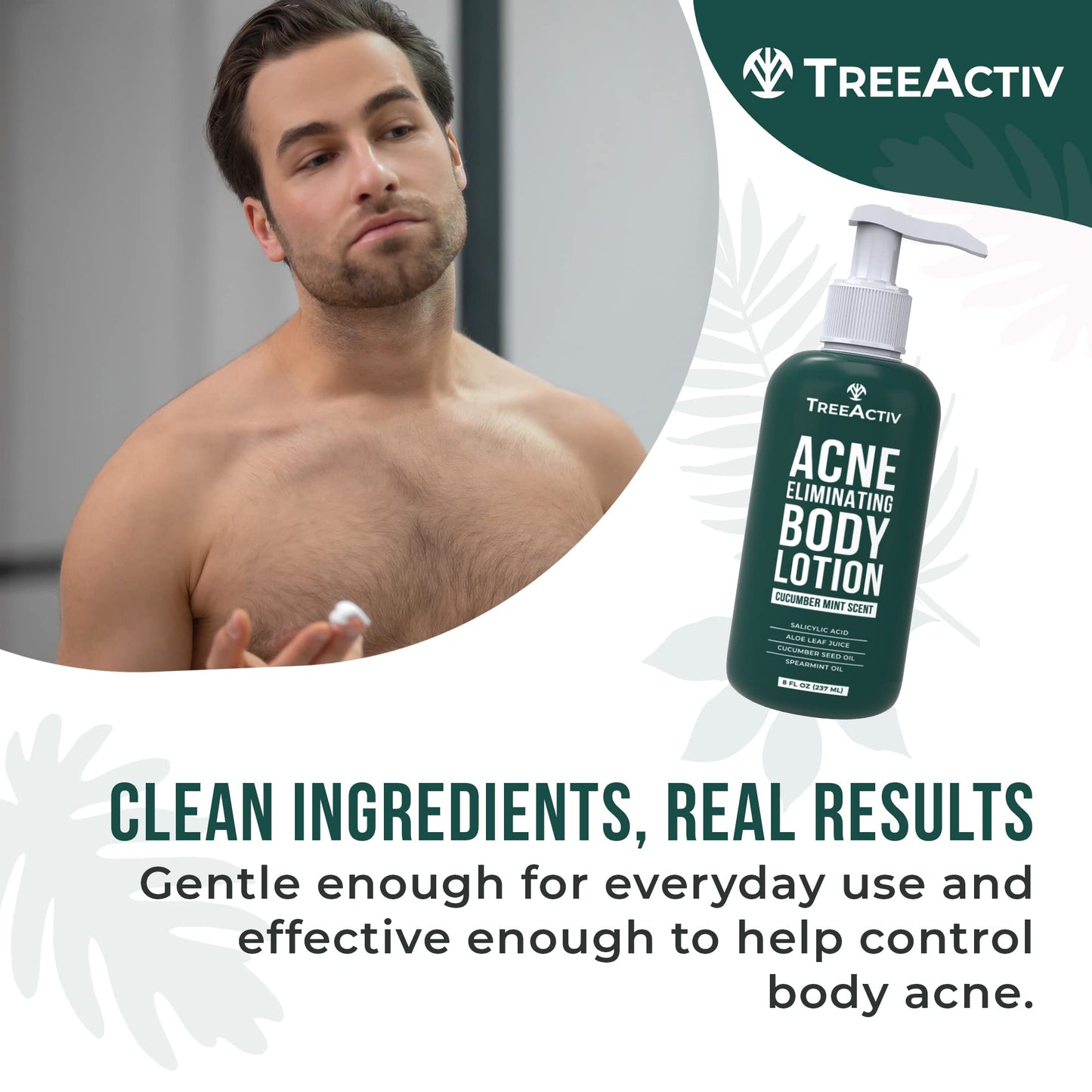TreeActiv Acne Eliminating Body Lotion 8 oz | Clears Body, Back, Butt & Shoulders | Cucumber Mint