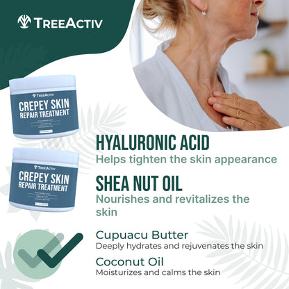 TreeActiv Crepey Skin Repair Cream – Firming Hyaluronic Acid Lotion (8 oz)