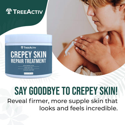 TreeActiv Crepey Skin Repair Cream – Firming Hyaluronic Acid Lotion (8 oz)