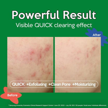 Troubless Clear Toner Pad for Face | Gentle Peeling & Soothing Tea Tree, 60 Pads