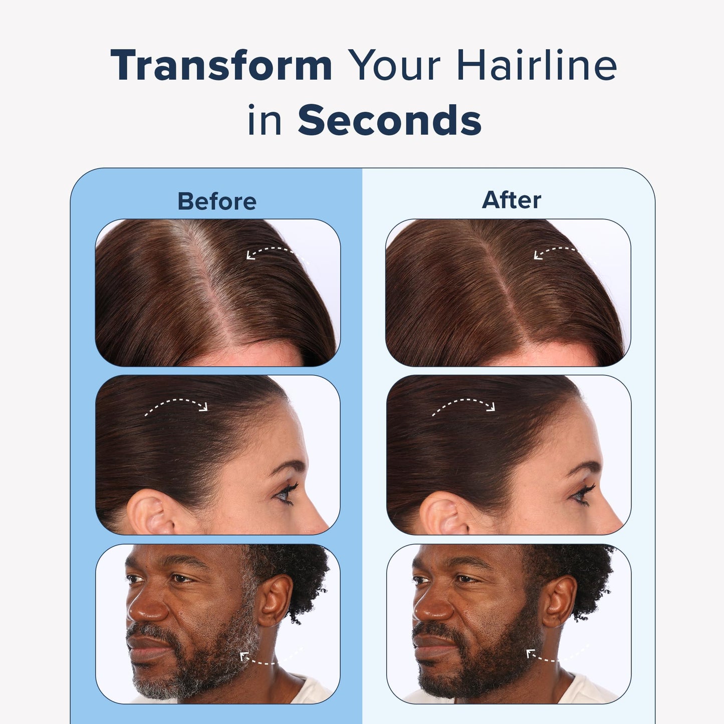 TRUHAIR Jumbo Color & Conceal – Waterproof Root Touch Up for Gray Hair Coverage