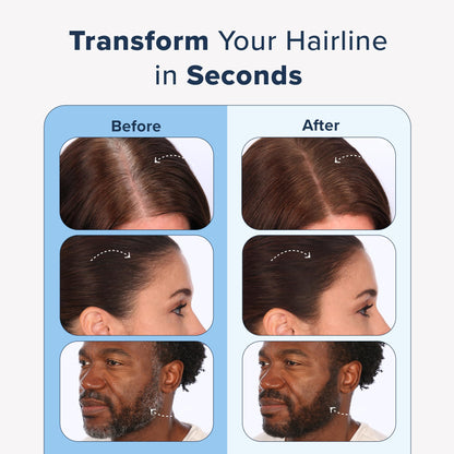 TRUHAIR Jumbo Color & Conceal – Waterproof Root Touch Up for Gray Hair Coverage