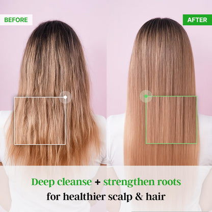 TS SHAMPOO Premium Biotin Shampoo for Hair Support – 10.14 oz / 300 g (Korean formula)