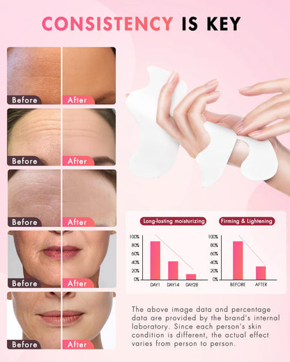 UKVOA Facial Forehead & Smile Line Patches – Overnight Hydration (36 pcs)