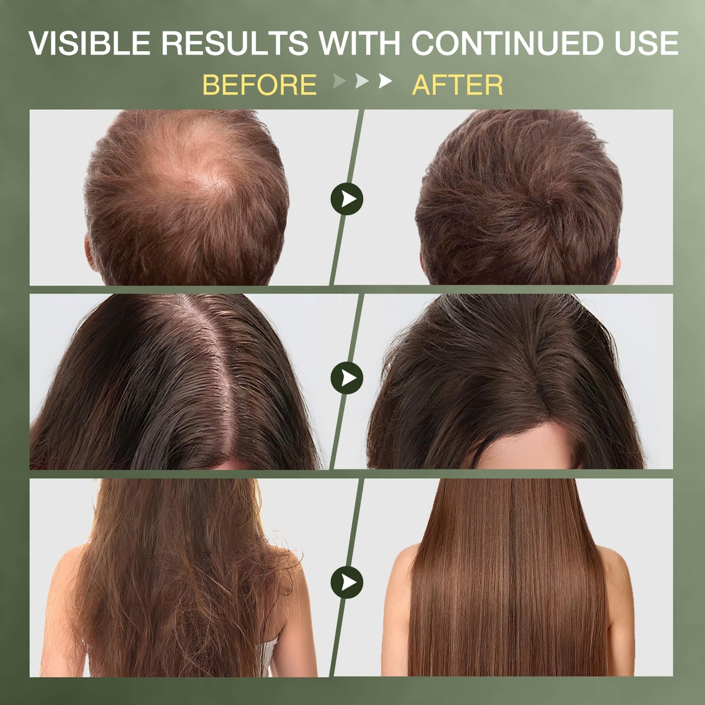 ulluxe Raw Batana Oil – 100% Natural Unrefined Hair Growth Oil from Honduras