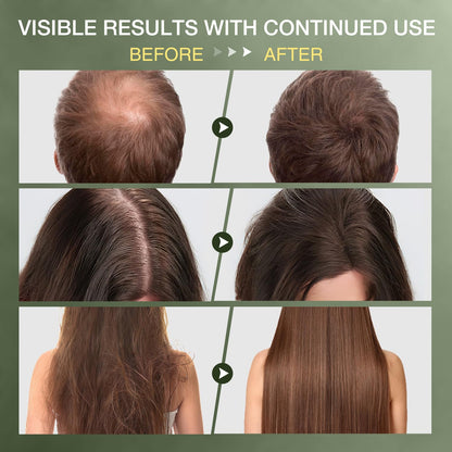 ulluxe Raw Batana Oil – 100% Natural Unrefined Hair Growth Oil from Honduras