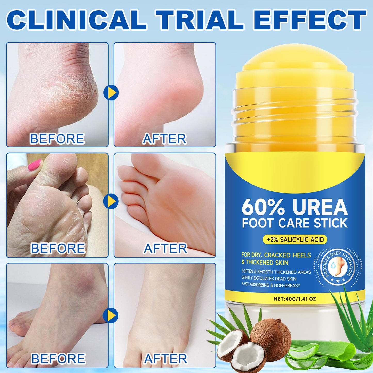 60% Urea Foot Care Stick with 2% Salicylic Acid – Deep Moisture & Gentle Exfoliation, 1.41 oz