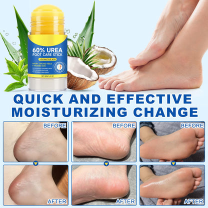 Urea 60% & Salicylic Acid 2% Moisturizing Stick Balm – Callus Softener for Feet & Hands (40g)